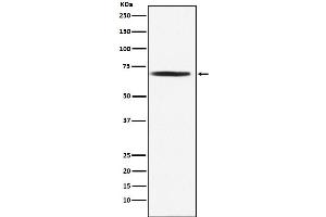 Western blot analysis of DLAT expression in Jurkat cell lysate.