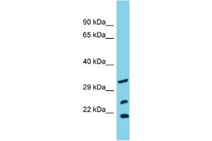 Host: Rabbit Target Name: SLC25A17 Sample Type: OVCAR-3 Whole Cell lysates Antibody Dilution: 1. (SLC25A17 anticorps  (N-Term))