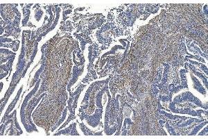 IHC analysis of Filamin A/FLNA using anti-Filamin A/FLNA antibody (ABIN7601783). (Filamin A anticorps  (AA 451-638))