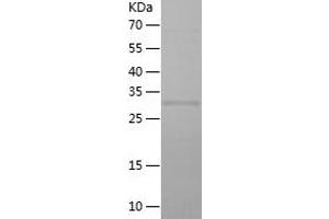Western Blotting (WB) image for Elongation Factor, RNA Polymerase II, 2 (ELL2) (AA 350-572) protein (His tag) (ABIN7122763)