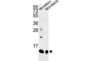 Western blot analysis of Cornifin-B (arrow) in MDA-MB231, MDA-MB435 cell line lysates (35ug/lane) using SPRR1B / Cornifin-B Antibody (C-term). (SPRR1B anticorps  (C-Term))