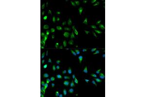 Immunofluorescence analysis of HeLa cells using RASSF1 antibody. (RASSF1 anticorps)