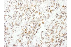 Immunohistochemistry (IHC) image for anti-Cullin 1 (CUL1) (AA 250-300) antibody (ABIN7454487)