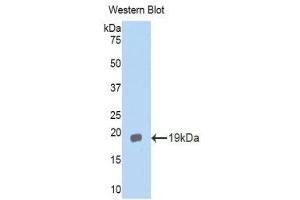 Western Blotting (WB) image for anti-Interleukin 11 Receptor, alpha (IL11RA) (AA 194-329) antibody (ABIN3203901) (IL11RA anticorps  (AA 194-329))