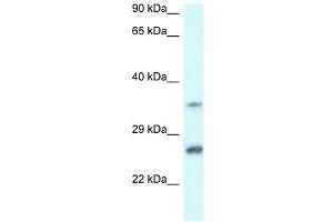Western Blot showing CBR4 antibody used at a concentration of 1 ug/ml against Jurkat Cell Lysate