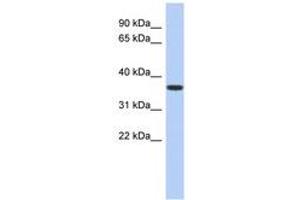 Image no. 1 for anti-Mevalonate Kinase (MVK) (AA 107-156) antibody (ABIN6743974) (MVK anticorps  (AA 107-156))