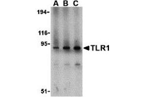 Western Blotting (WB) image for anti-Toll-Like Receptor 1 (TLR1) (N-Term) antibody (ABIN1031619) (TLR1 anticorps  (N-Term))
