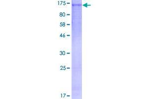 Image no. 1 for Budding Uninhibited By Benzimidazoles 1 Homolog (Yeast) (BUB1) (AA 1-1085) protein (GST tag) (ABIN1346981)