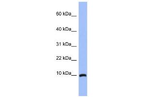 WB Suggested Anti-ACBD7 Antibody Titration: 0. (ACBD7 anticorps  (N-Term))