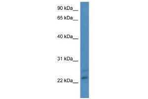 WB Suggested Anti-CBR4 Antibody Titration: 0. (CBR4 anticorps  (N-Term))