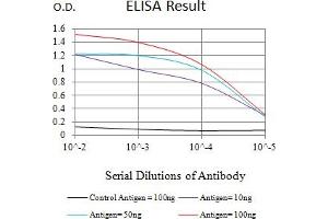 Black line: Control Antigen (100 ng),Purple line: Antigen (10 ng), Blue line: Antigen (50 ng), Red line:Antigen (100 ng) (BAX anticorps)