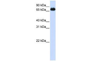 WB Suggested Anti-FOXK2 Antibody Titration:  0. (Forkhead Box K2 anticorps  (Middle Region))