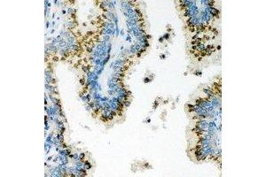 Immunohistochemical analysis of Unc18-2 staining in human prostate formalin fixed paraffin embedded tissue section. (STXBP2 anticorps)