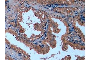 Detection of TUBb in Human Prostate Tissue using Monoclonal Antibody to Tubulin Beta (TUBb)