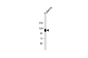 Anti-ITIH4 Antibody (C-Term) at 1:2000 dilution + human plasma lysate Lysates/proteins at 20 μg per lane. (ITIH4 anticorps  (AA 885-917))