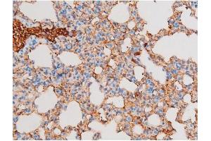ABIN6267603 at 1/200 staining Mouse lung tissue sections by IHC-P.