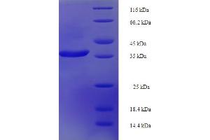 SDS-PAGE (SDS) image for RAB, Member RAS Oncogene Family-Like 5 (RABL5) (AA 1-185), (full length) protein (His-SUMO Tag) (ABIN5711781)