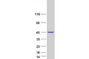 Validation with Western Blot