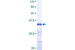 Image no. 1 for Regulatory Factor X 5 (RFX5) (AA 516-616) protein (GST tag) (ABIN1317890)
