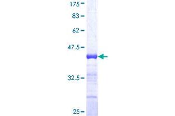 RFX5 Protein (AA 516-616) (GST tag)