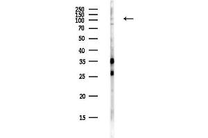 anti-Smg-5 Homolog, Nonsense Mediated mRNA Decay Factor (SMG5) antibody