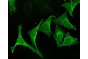 Immunocytochemistry/Immunofluorescence analysis using Rabbit Anti-Calnexin Polyclonal Antibody (ABIN361826 and ABIN361827).