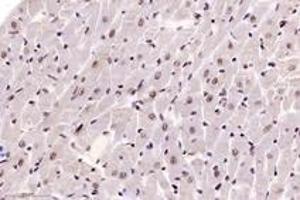 Immunohistochemistry analysis of paraffin-embedded rat heart using,DAZAP1 (ABIN7073691) at dilution of 1: 6000