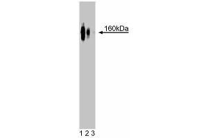 Western blot analysis of delta-Catenin on rat brain lysate.