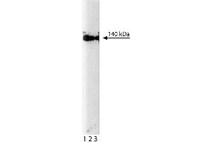 Western blot analysis of eNOS/NOS Type III on human endothelial cell lysate. (ENOS anticorps  (AA 1025-1203))
