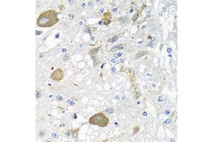 Immunohistochemistry of paraffin-embedded rat brain using IFNL3 antibody at dilution of 1:100 (40x lens). (IL28B anticorps)