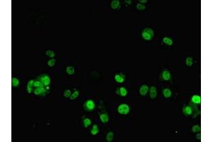 Immunofluorescent analysis of MCF-7 cells using ABIN7176421 at dilution of 1:100 and Alexa Fluor 488-congugated AffiniPure Goat Anti-Rabbit IgG(H+L) (ZNF596 anticorps  (AA 201-504))