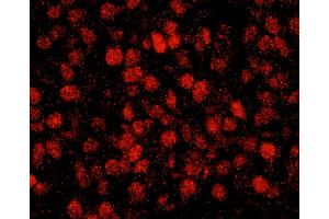 Immunofluorescence (IF) image for anti-REST Corepressor 3 (RCOR3) (AA 445-495) antibody (ABIN7449047) (RCOR3 anticorps  (AA 445-495))