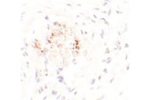 Immunohistochemical analysis of LEMD3 in human colon tissue with LEMD3 polyclonal antibody  at 2. (LEMD3 anticorps  (C-Term))