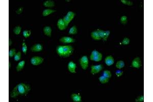 Immunofluorescent analysis of MCF-7 cells using ABIN7166049 at dilution of 1:100 and Alexa Fluor 488-congugated AffiniPure Goat Anti-Rabbit IgG(H+L) (S100A16 anticorps  (AA 1-103))
