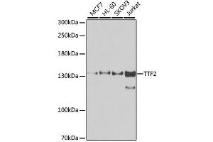 Western blot analysis of extracts of various cell lines, using TTF2 antibody. (TTF2 anticorps  (AA 1-270))