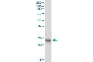 RRAS2 monoclonal antibody (M01), clone 2D3-4B8.