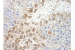 Immunohistochemistry (IHC) image for anti-Pogo Transposable Element with ZNF Domain (POGZ) (AA 1360-1410) antibody (ABIN7448730) (POGZ anticorps  (AA 1360-1410))