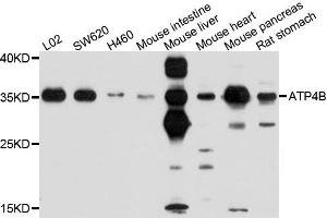 Western blot analysis of extracts of various cells, using ATP4B antibody. (ATP4b anticorps)