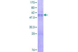 Image no. 1 for Transmembrane Protein 123 (TMEM123) (AA 1-208) protein (GST tag) (ABIN1322961)