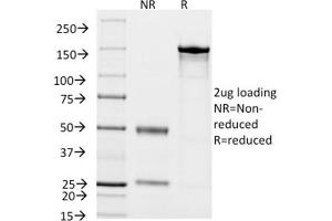 SDS-PAGE Analysis of Purified CD14 Mouse Monoclonal Antibody ABIN6383875.