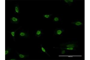 Immunofluorescence of monoclonal antibody to PAX8 on HeLa cell. (PAX8 anticorps  (AA 141-250))