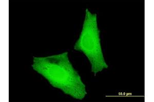 Immunofluorescence of monoclonal antibody to MAF on HeLa cell.