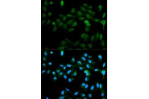 Immunofluorescence analysis of MCF-7 cells using CYP11A1 antibody.