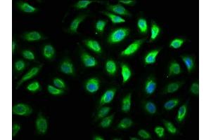 Immunofluorescence staining of A549 cells with ABIN7174953 at 1:100, counter-stained with DAPI.