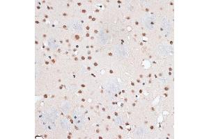 Immunohistochemistry of paraffin-embedded mouse brain using RBM3 antibody  at dilution of 1:100 (40x lens).