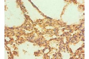 Immunohistochemistry of paraffin-embedded human lung tissue using ABIN7146530 at dilution of 1:100