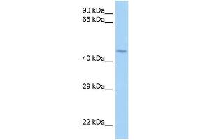WB Suggested Anti-LRRFIP2 Antibody Titration: 1. (LRRFIP2 anticorps  (N-Term))