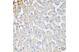 Immunohistochemistry of paraffin-embedded human liver injury using COX5B antibody.
