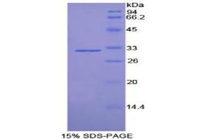 SDS-PAGE analysis of Rat Tubulin delta Protein. (TUBD1 Protéine)