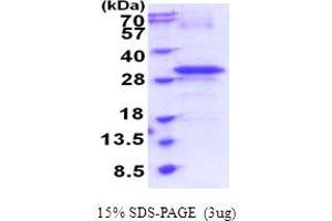 SDS-PAGE (SDS) image for Receptor (Chemosensory) Transporter Protein 4 (RTP4) (AA 1-224) protein (His tag) (ABIN5854002) (RTP4 Protein (AA 1-224) (His tag))
